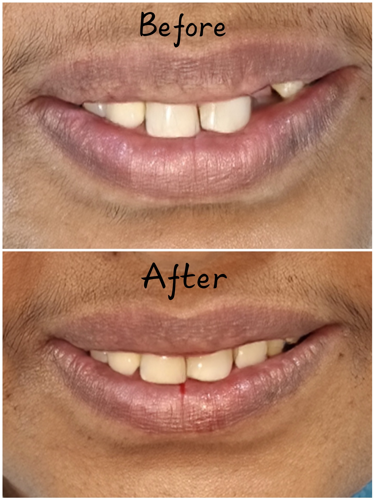 Sri Ram Dental Care Madurai
