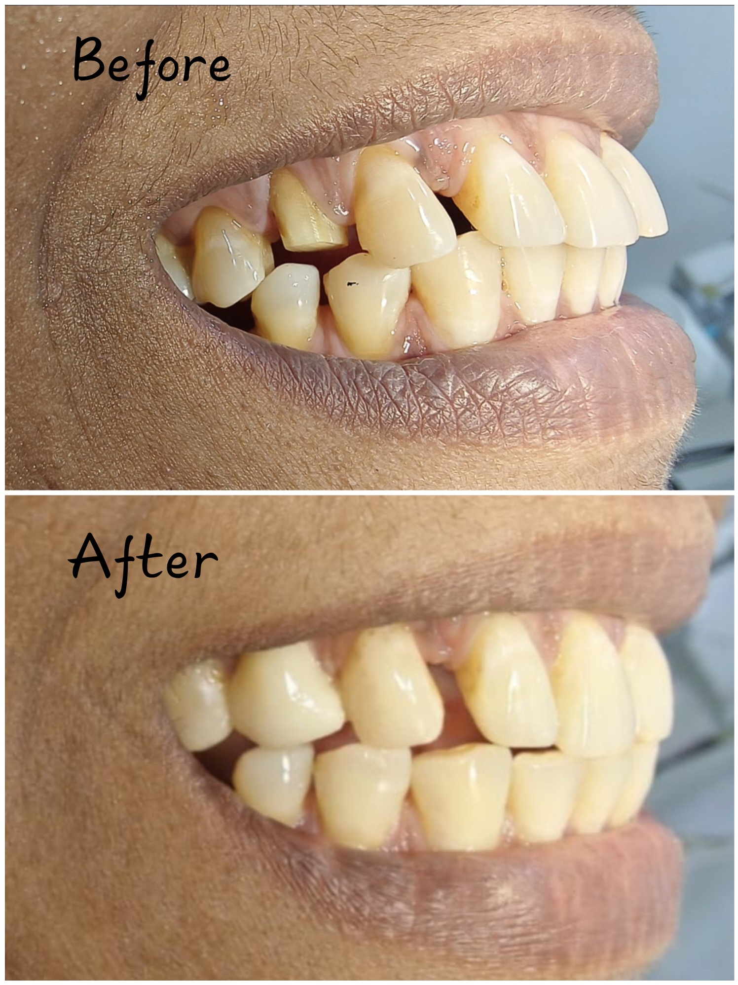 Advanced dental equipment