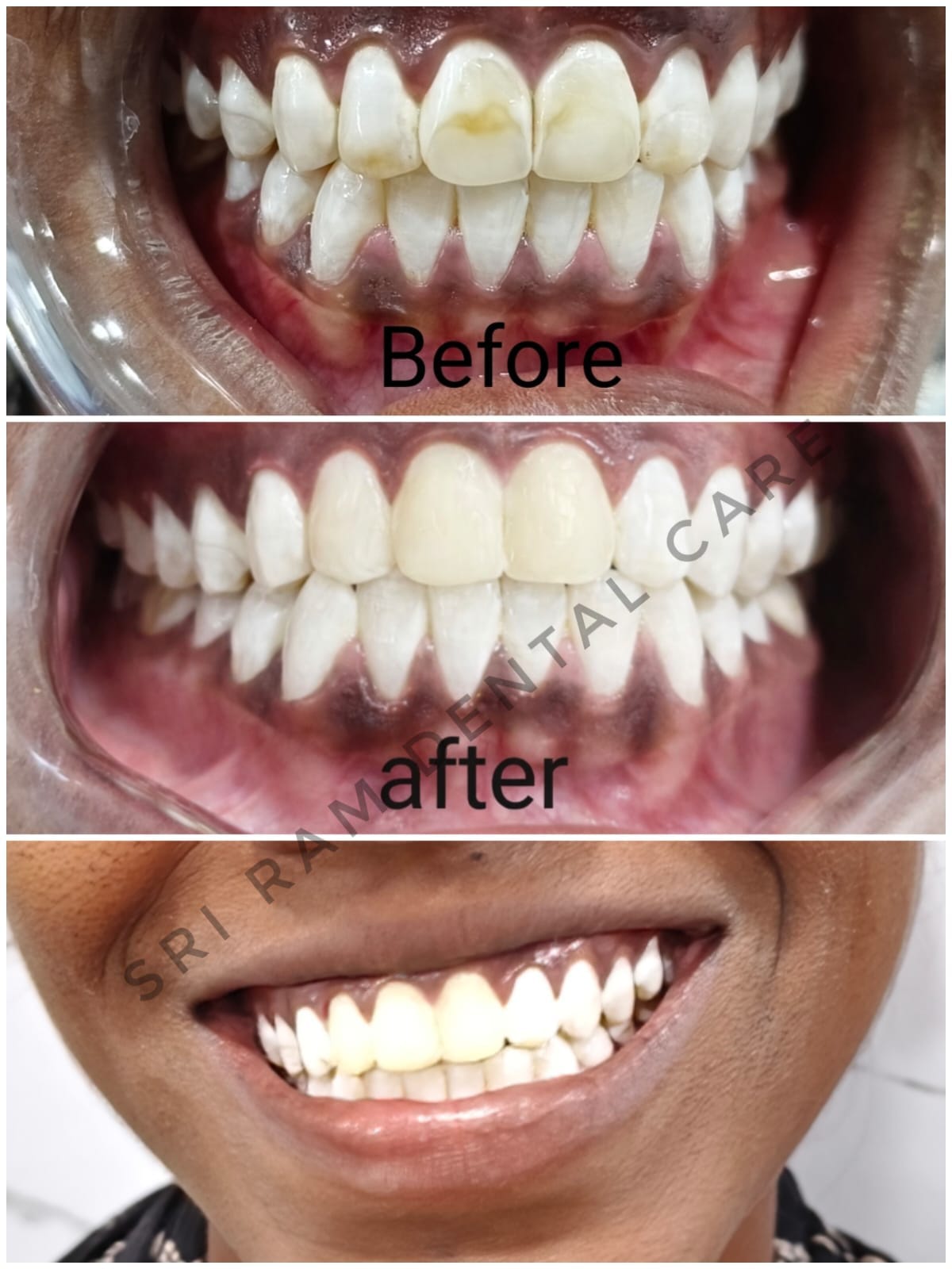 Dental procedure Madurai