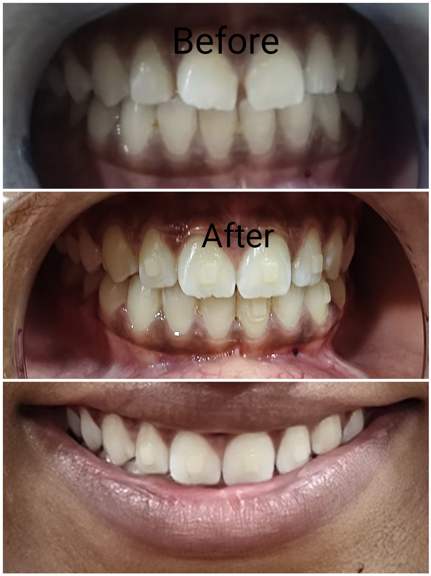 Sri Ram Dental Care clinic