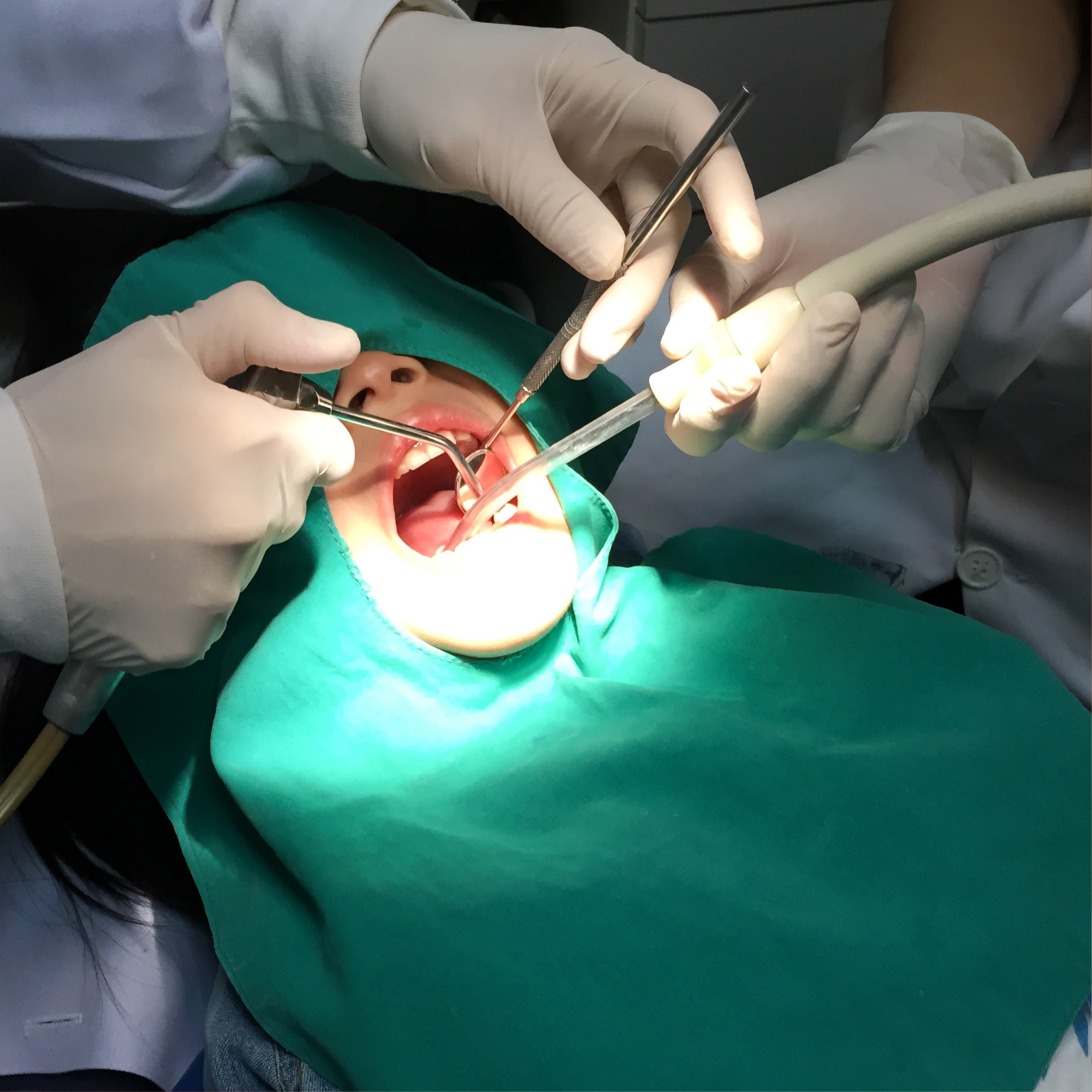 Oral Surgery Madurai