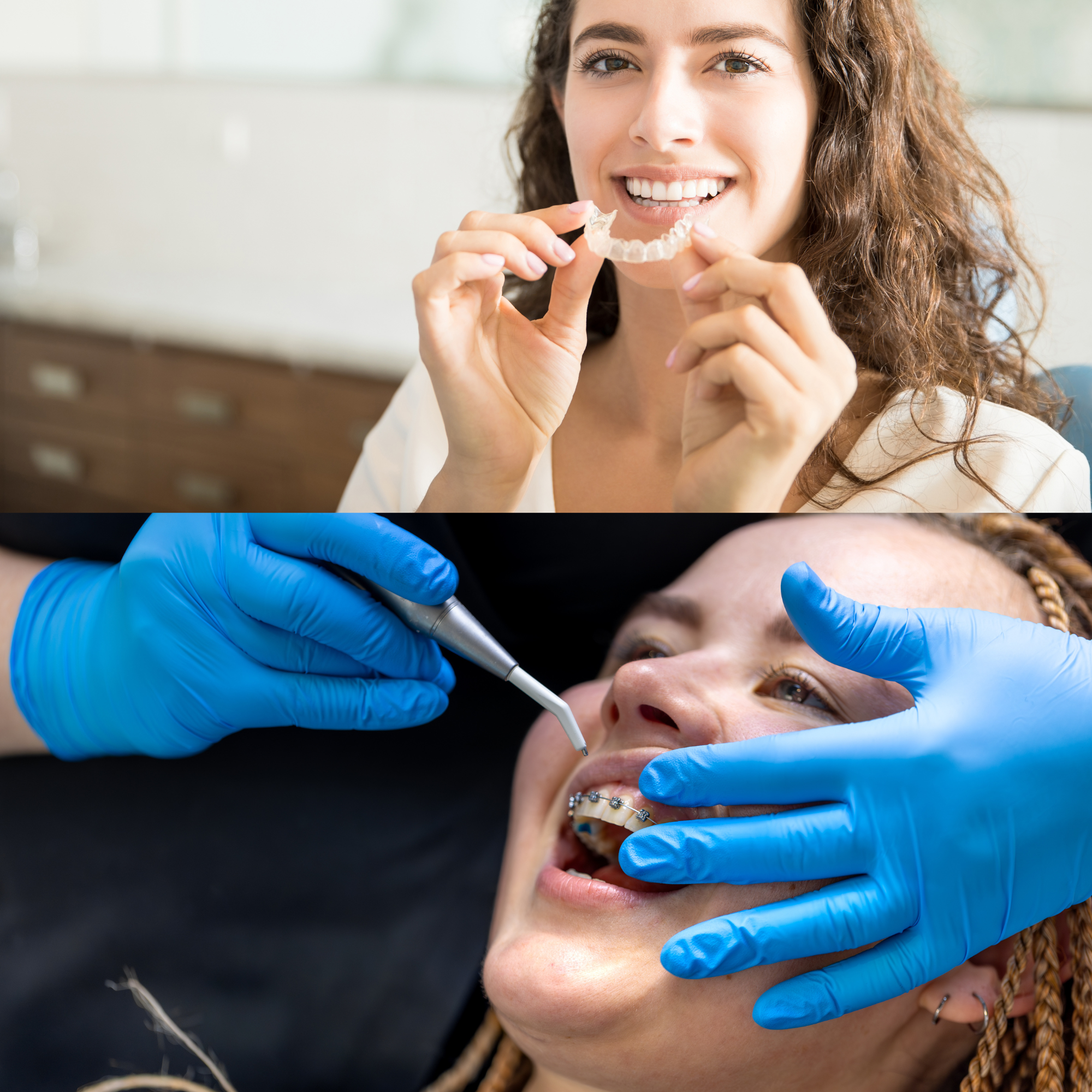 Teeth Alignment Madurai